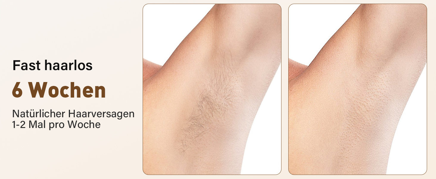 Пристрій для епіляції IPL з лазером та охолодженням, 3 функції (HR/SC/RA), 9 рівнів енергії, 999 999 імпульсів, для чоловіків/жінок/обличчя/бікіні/тіла (білий)