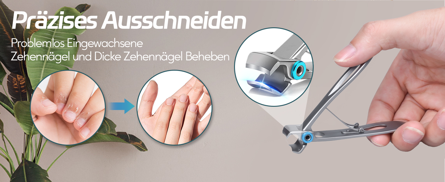 Набір для манікюру та педикюру Softale: професійний набір для догляду за нігтями, видалення врослих та твердих мозолів, 6 предметів