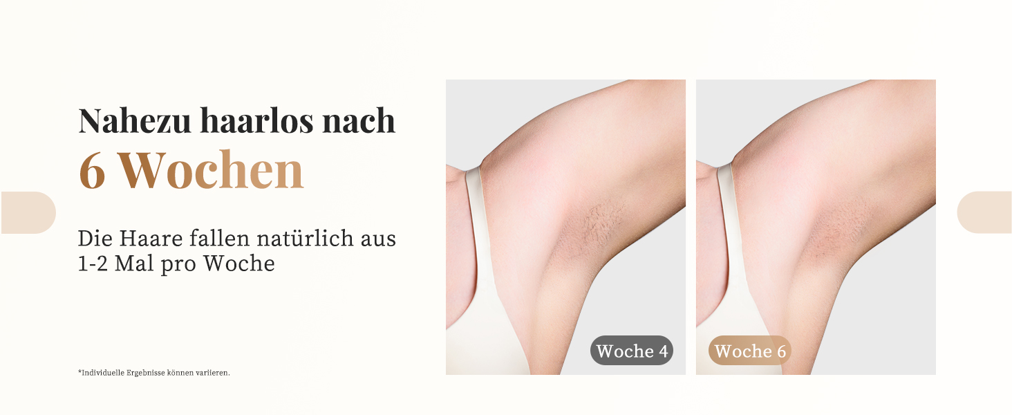 Пристрій для епіляції IPL Haarlosy - безболісна епіляція вдома для жінок та чоловіків, 9 рівнів, 999,900 імпульсів, 3 функції (HR/SC/RA), для тіла, ніг, зони бікіні, під пахвами, Platin