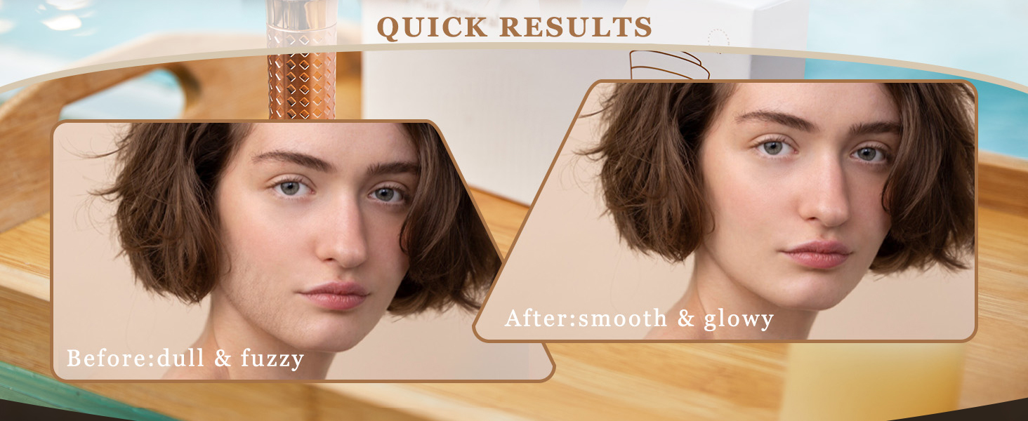 Електричний прилад для видалення волосся для жінок, бездротовий депілятор, безболісний електробритва для губ, рук, обличчя, пушкового волосся (Золотий)