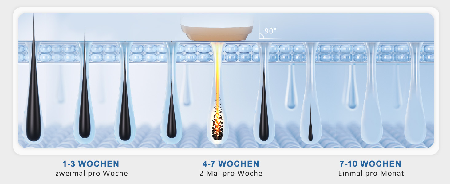 Пристрій для епіляції IPL NALONE, лазерне видалення волосся, 999 999 імпульсів, для жінок та чоловіків, 1200 нм, 2 режими, болюча епіляція для всього тіла, білий (золотий)