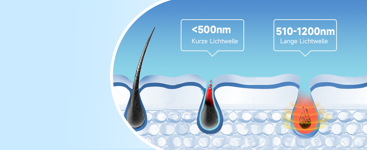 Пристрій для епіляції IPL MLAY: Швидка та безболісна епіляція лазером для обличчя, тіла та зони бікіні (для чоловіків та жінок)