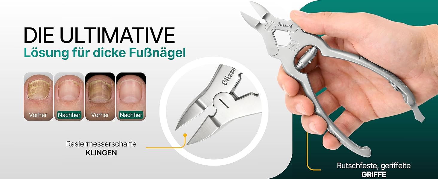 Професійний інструмент для педикюру: щипці для видалення врослих та товстих нігтів, з пилочкою, 15 см, нержавіюча сталь