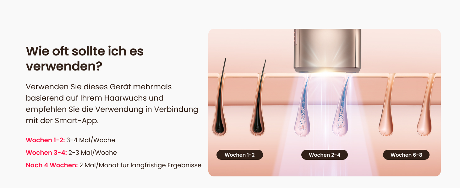 Пристрій для епіляції IPL, 25 Дж, лазерне видалення волосся для жінок та чоловіків, безболісна технологія охолодження сапфіром, довготривалий ефект для зони бікіні, ніг, пахв, тіла, колір: шампань-золото