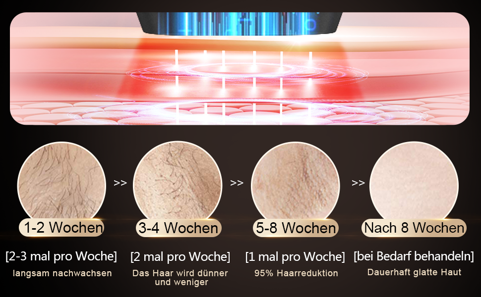 Пристрій для епіляції IPL з сапфіровим наконечником, охолодженням та 500 000 імпульсів світла. 2 насадки для обличчя, тіла, зони бікіні та пахв. Постійне видалення волосся. Violett