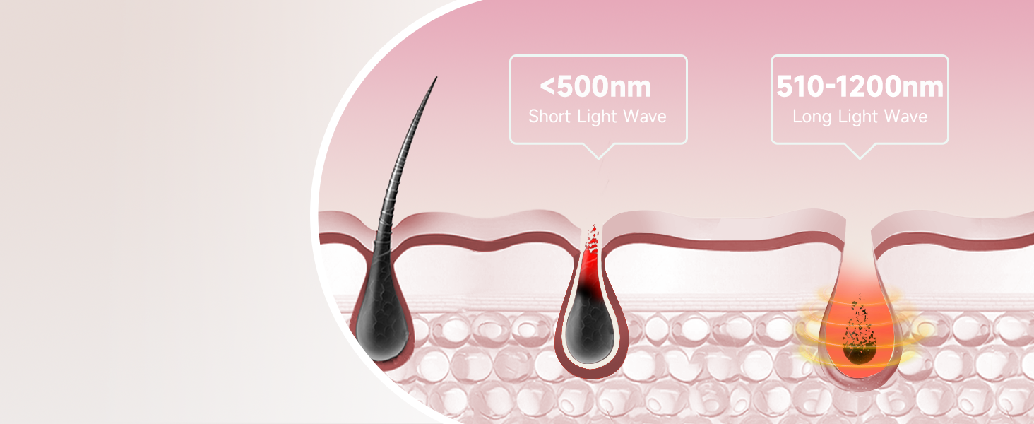 MLAY IPL пристрій для епіляції лазером: швидка та безболісна епіляція для тіла, обличчя та зони бікіні. Підходить для чоловіків та жінок. (Червоний)