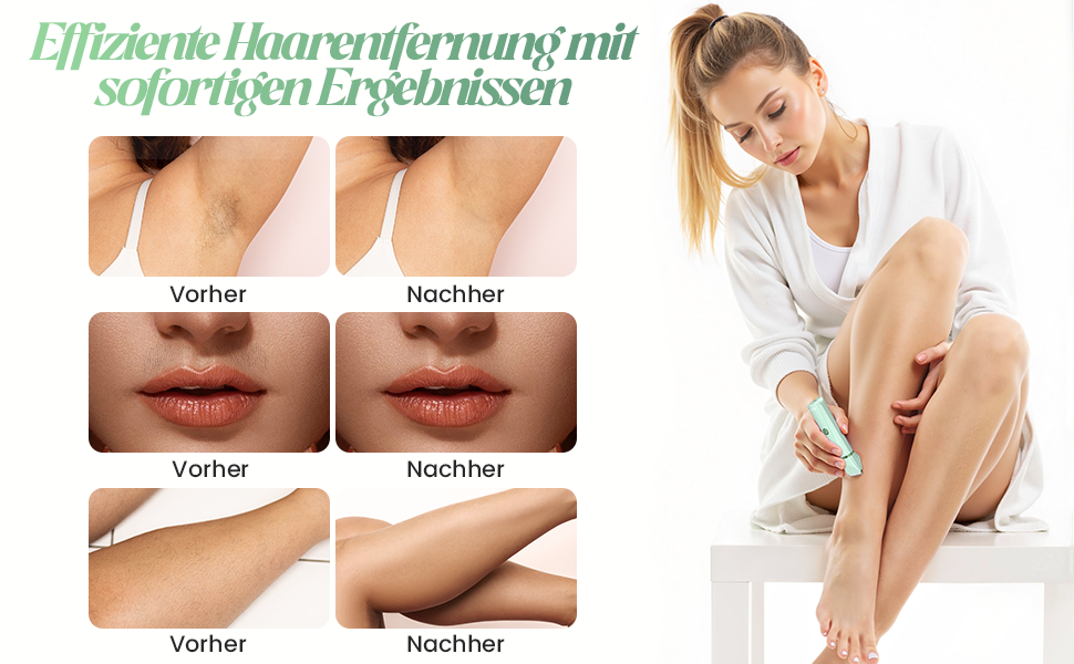 Електричний жіночий епілятор для тіла та обличчя, для інтимної зони, USB, зелений