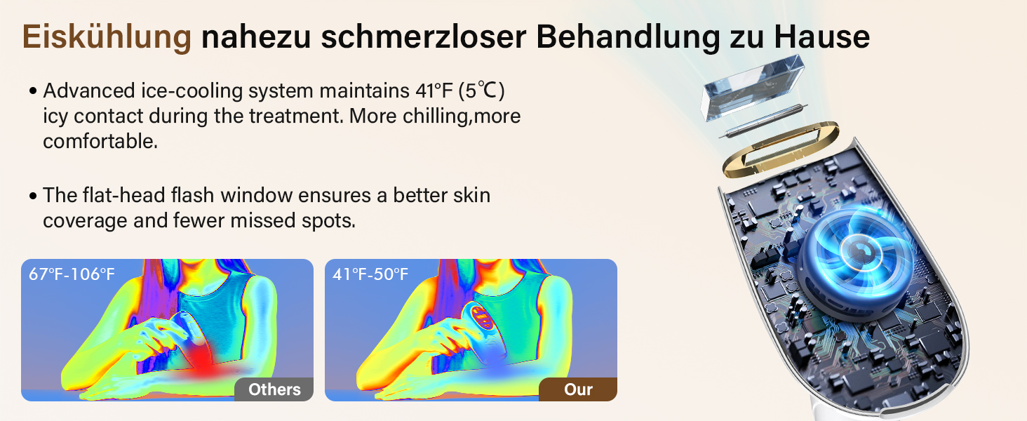 Пристрій для епіляції IPL з лазером та охолодженням, 3 функції (HR/SC/RA), 9 рівнів енергії, 999 999 імпульсів, для чоловіків/жінок/обличчя/бікіні/тіла (білий)