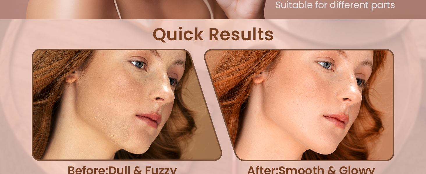 Електричний жіночий тример для обличчя iFanzeTech: для швидкої та ніжної стрижки верхньої губи, підборіддя та щік. Змінна головка в комплекті.