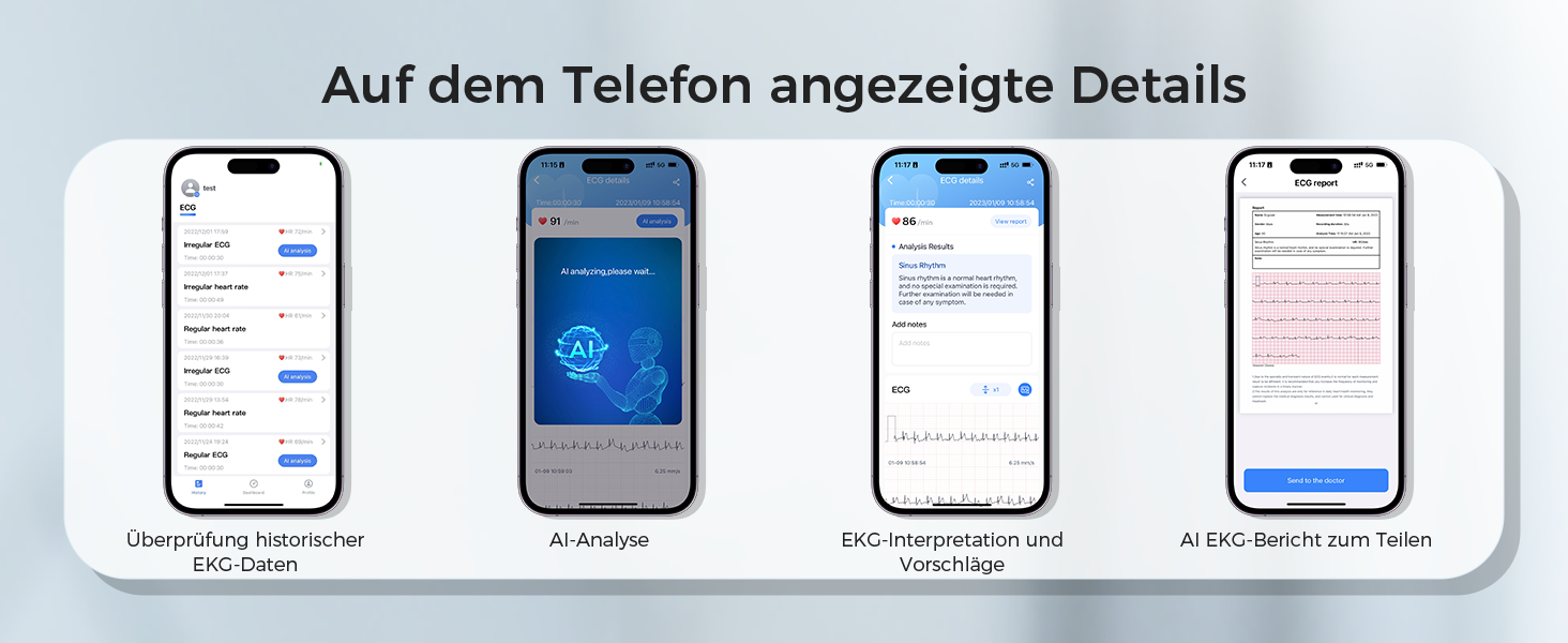 Тонометр CheckMe BP2 Connect на плечі з ЕКГ та AI-аналізом, середнє значення з 3 вимірювань, Bluetooth & WiFi, вимірювання пульсу, APP безлімітна база даних (Android&iOS)