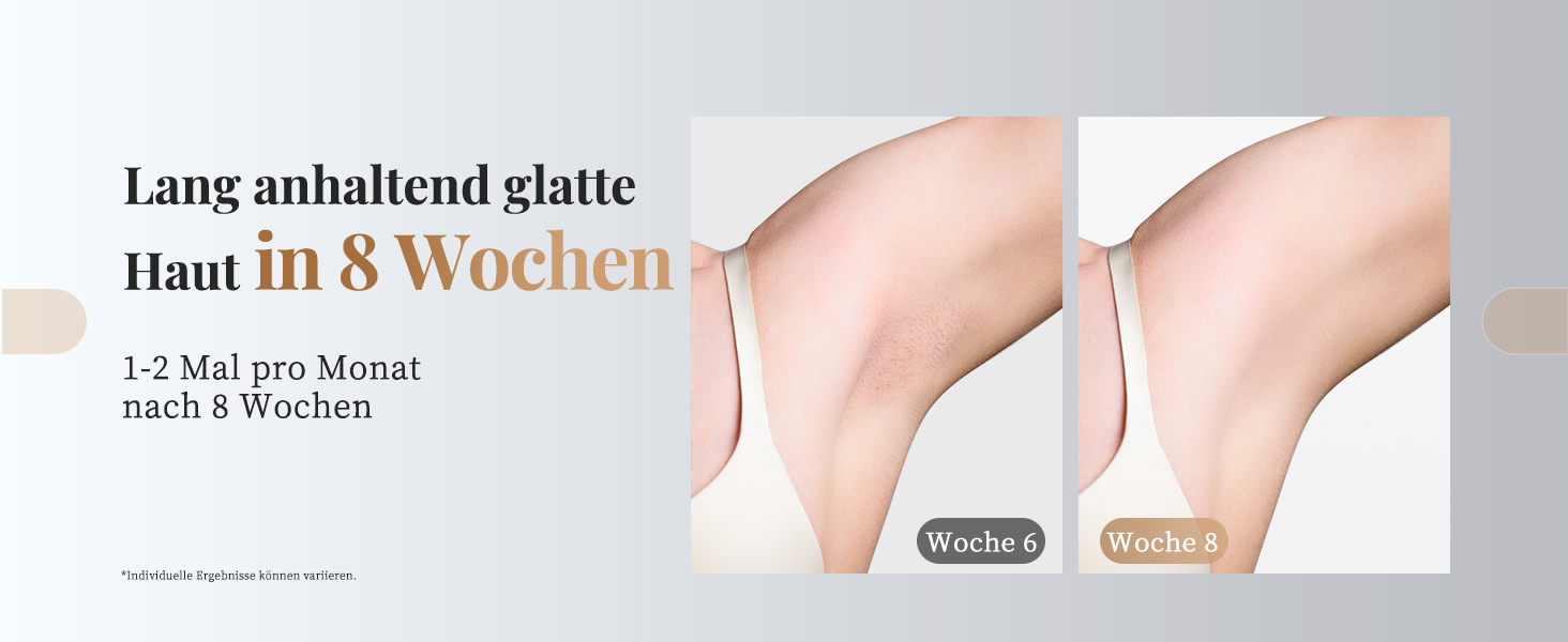 Пристрій для епіляції IPL Haarlosy: безболісна епіляція вдома для жінок та чоловіків, 9 рівнів, 999,900 імпульсів, 3 функції (HR/SC/RA), для тіла, ніг, зони бікіні, пахв. Чорний колір.