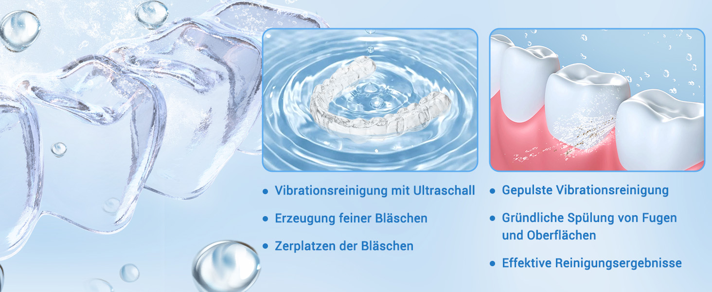 Ультразвуковий очищувач 48000Hz з УФ-дезінфекцією для зубних кап, брекетів, протезів та ювелірних виробів - 300 мл, 24 Вт