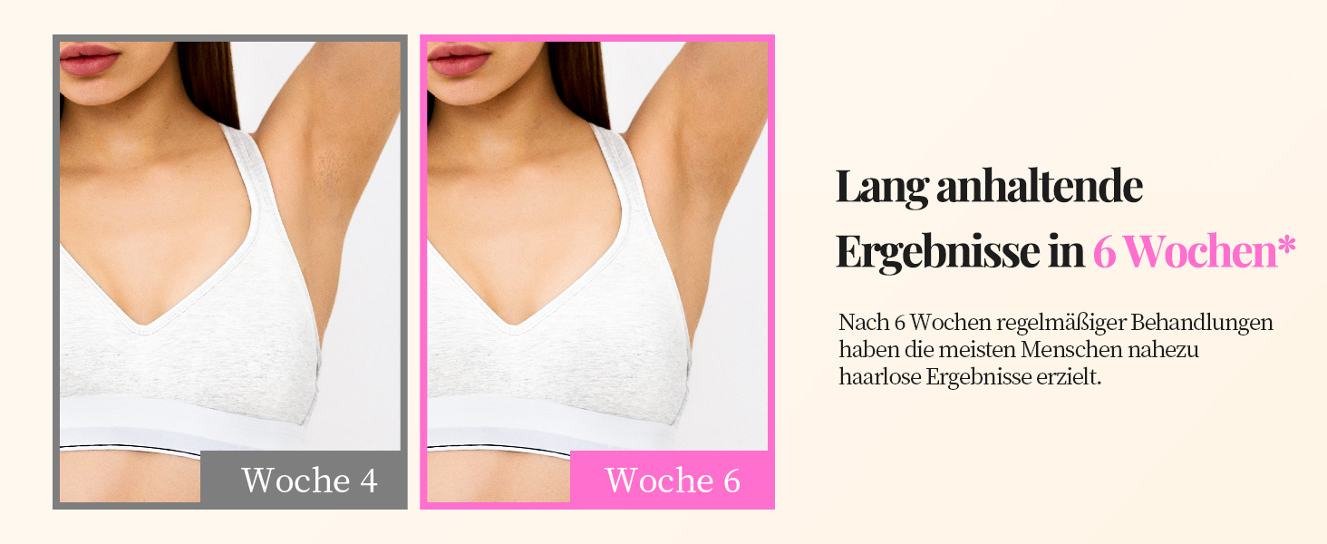 Пристрій для епіляції IPL Haarlosy - безболісна епіляція лазером, для дому, 9 рівнів, захист шкіри, для жінок та чоловіків, для обличчя, бікіні, тіла, білий (рожевий)