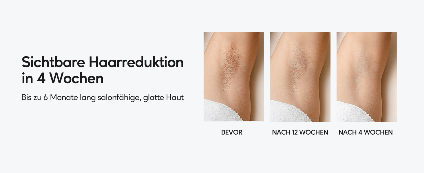 Прилад для епіляції IPL з охолодженням, 999 999 імпульсів, безболісна епіляція, 9 рівнів інтенсивності, для обличчя, бікіні, тіла, білий