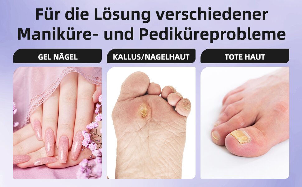 Електричний набір для манікюру та педикюру Nagelfräser: 11 насадок, 9 швидкостей, до 10000 об/хв