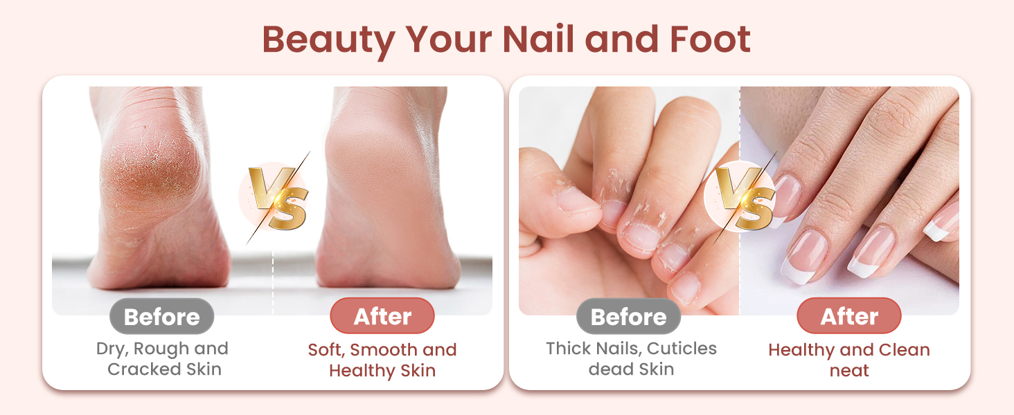 Електричний фрезер для манікюру та педикюру з 6 насадками, 10 швидкостей, LED-підсвічуванням, акумуляторний, для догляду за нігтями