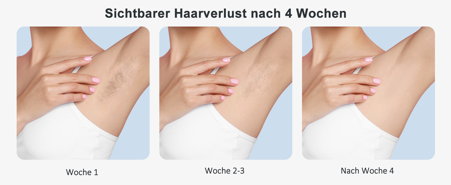 Пристрій для епіляції IPL NALONE: безболійна епіляція лазером для тіла, 1200 нм, 2 режими, для жінок та чоловіків