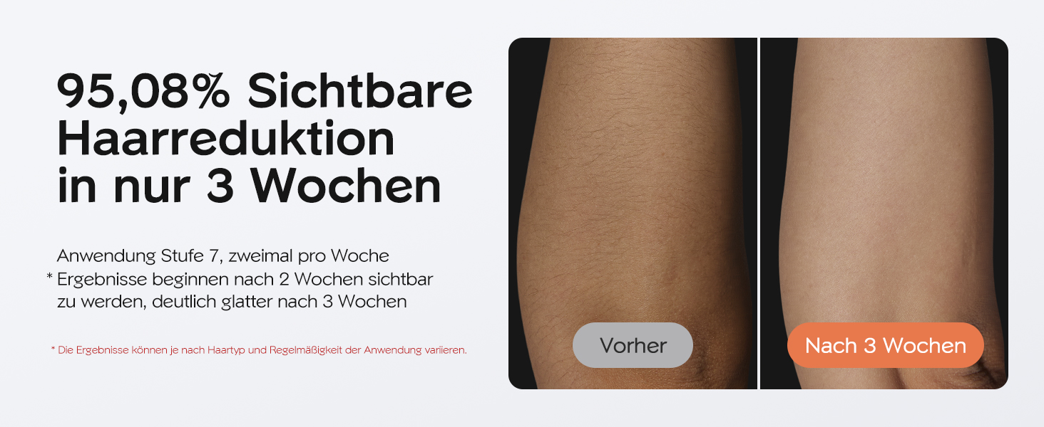 IPL пристрій для епіляції Innza з охолодженням, 999 999 імпульсів, 9 рівнів потужності, для обличчя, зони бікіні та тіла