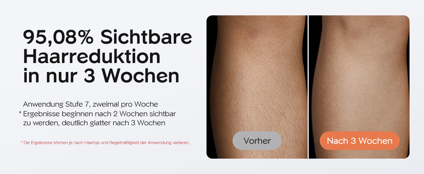 IPL пристрій для епіляції Innza з охолодженням, 999 999 імпульсів, 9 рівнів потужності, для обличчя, зони бікіні та тіла