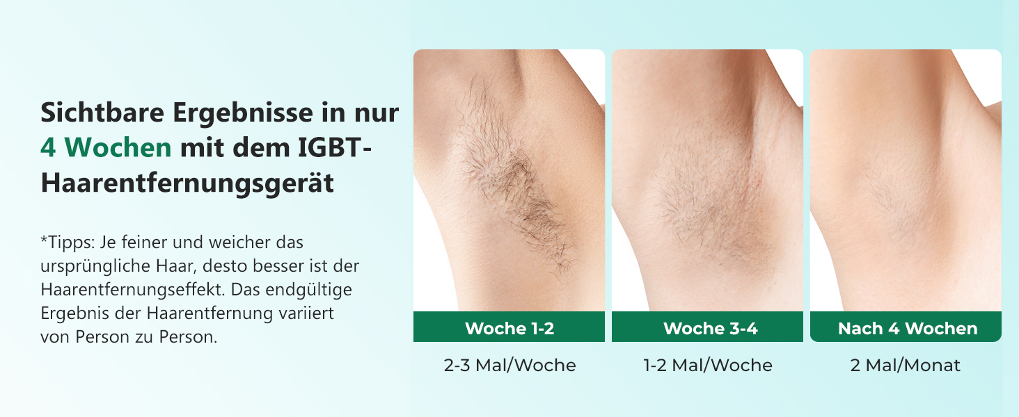 Пристрій для епіляції IPL з IGBT-технологією: швидка та ефективна епіляція для жінок та чоловіків. Підходить для обличчя, зони бікіні, тіла, ніг та під пахвами. Максимальна енергія 21J, 600-1200NM.