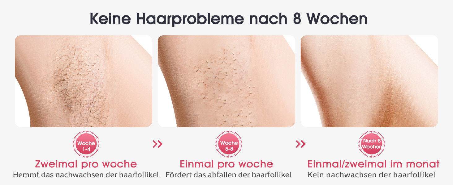 Пристрій для епіляції IPL Haarlosy з охолодженням, 999,900 імпульсів, 5 рівнів потужності, безболісна епіляція для жінок та чоловіків, обличчя, пахв, ніг та тіла (білий)