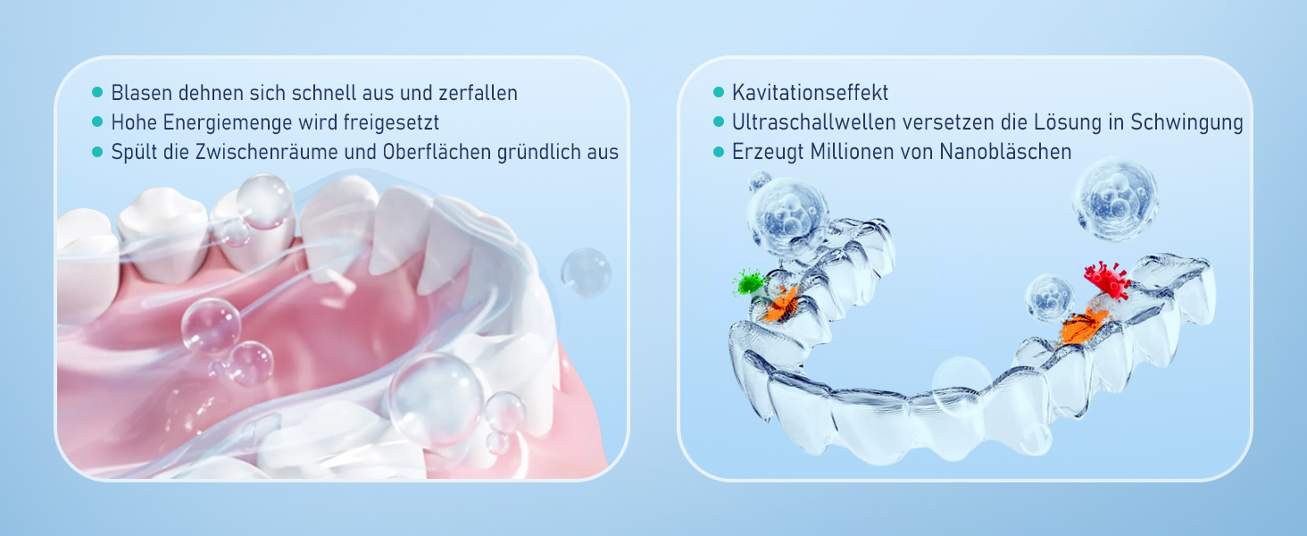 Ультразвуковий очищувач для стоматології 50kHz, 250мл з УФ-лампою (6 ламп) для брекетів, кап, ретейнерів, зубних протезів, елайнерів та ювелірних виробів, чорний