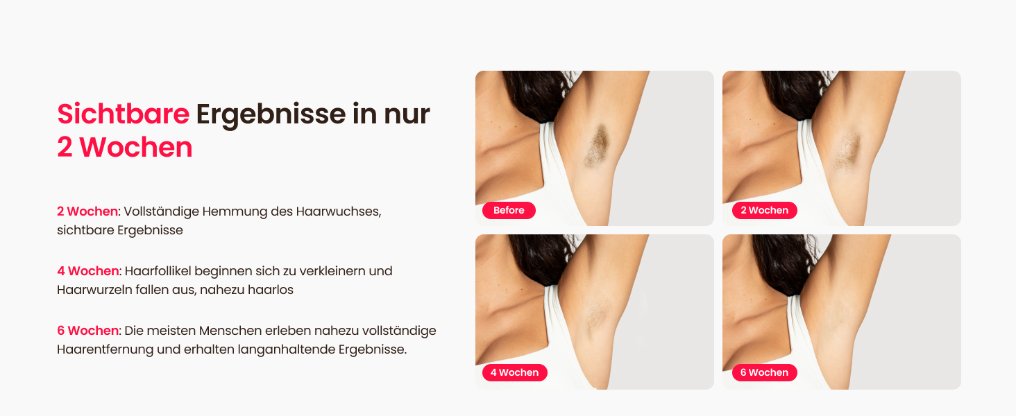 Пристрій для епіляції IPL, 25J, трипульсний лазер, для жінок та чоловіків, безболісна технологія охолодження сапфіром, довготривалий ефект для бікіні, ніг, пахв та тіла (темно-синій)