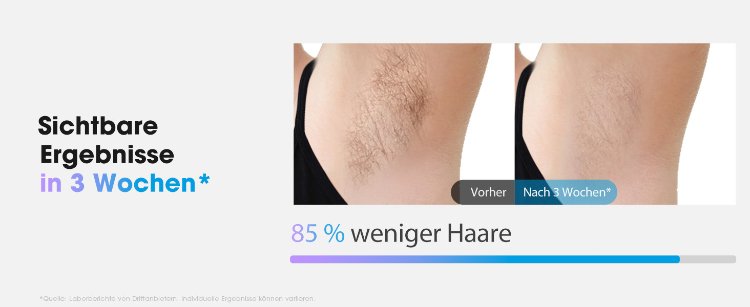 Пристрій для епіляції IPL Haarlosy з охолодженням, 5 рівнів потужності, 999,900 імпульсів світла, для жінок та чоловіків, обличчя, під пахвами, ноги, тіло (білий)