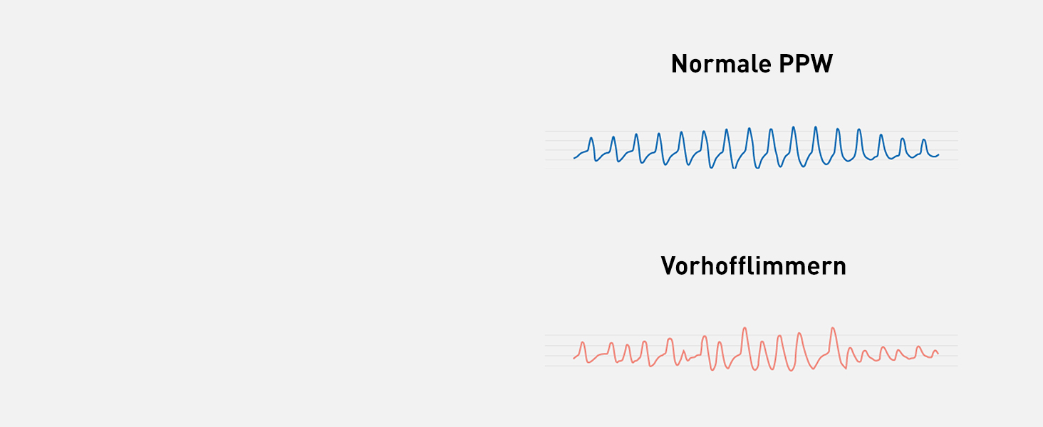 Тонометр OMRON X7 Smart AFIB: автоматичний, з визначенням фібриляції передсердь, клінічно перевірений, для діабетиків, з додатком для смартфона, 22-42 см