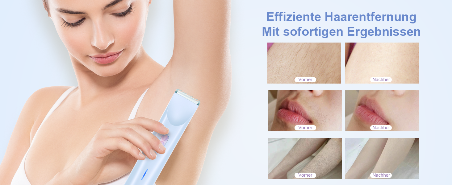 Електричний жіночий епілятор 2-в-1 з USB-C зарядкою, для обличчя, ніг та рук, вологостійкий тример, легко чистити (блакитний)