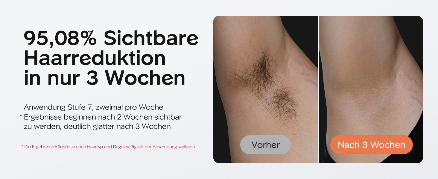 IPL пристрій для епіляції Innza з охолодженням, 999 999 імпульсів, 9 рівнів потужності, для обличчя, зони бікіні та тіла