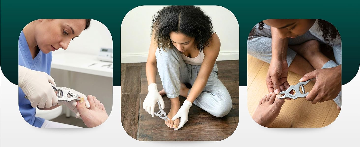 Професійний інструмент для педикюру: щипці для видалення врослих та товстих нігтів, з пилочкою, 15 см, нержавіюча сталь