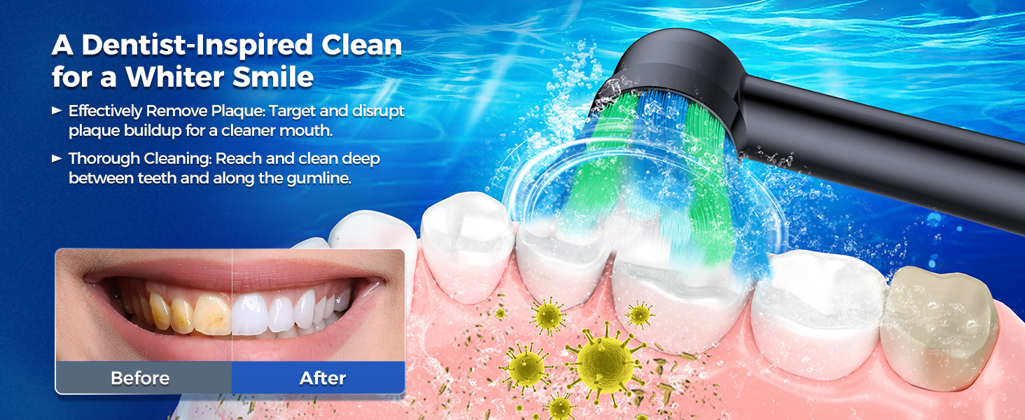 Електрична зубна щітка Rotierende для дорослих з 8 насадками, 4 режимами чищення, акумулятором на 60 днів та Smart-таймером на 2 хвилини - професійна електрична зубна щітка (чорна)