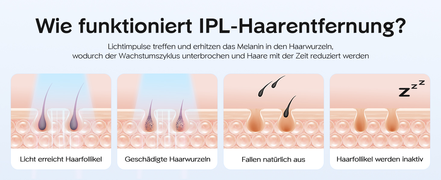 IPL пристрій для епіляції Innza з охолодженням, 999 999 імпульсів, 9 рівнів потужності, для обличчя, зони бікіні та тіла