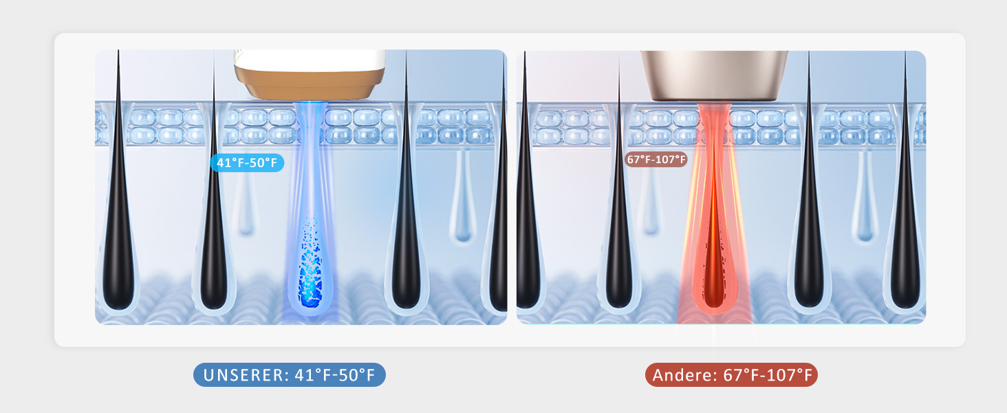 Пристрій для епіляції IPL NALONE, лазерне видалення волосся, 999 999 імпульсів, для жінок та чоловіків, 1200 нм, 2 режими, болюча епіляція для всього тіла, білий (золотий)