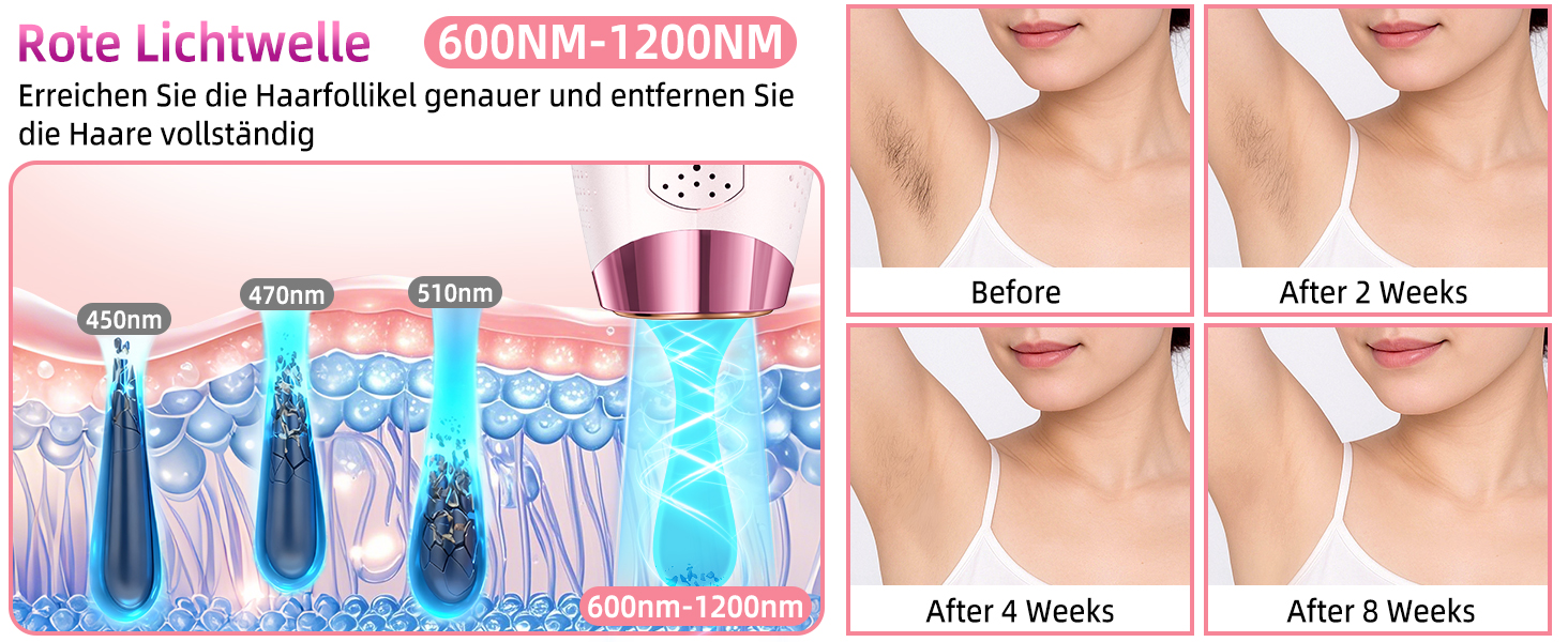 Епілятор IPL з лазером, 6.8 см², 3-в-1 для дому: обличчя, інтимна зона, ноги. 2 змінні насадки, HR/SC/RA технології. Для жінок