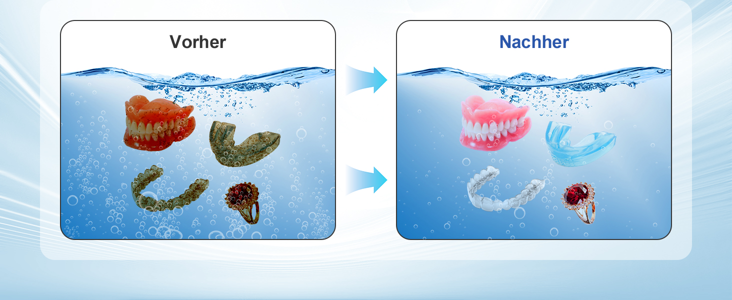 Ультразвуковий очищувач для зубних кап, брекетів та ювелірних виробів UV 45000Hz 24W - Dental Pod