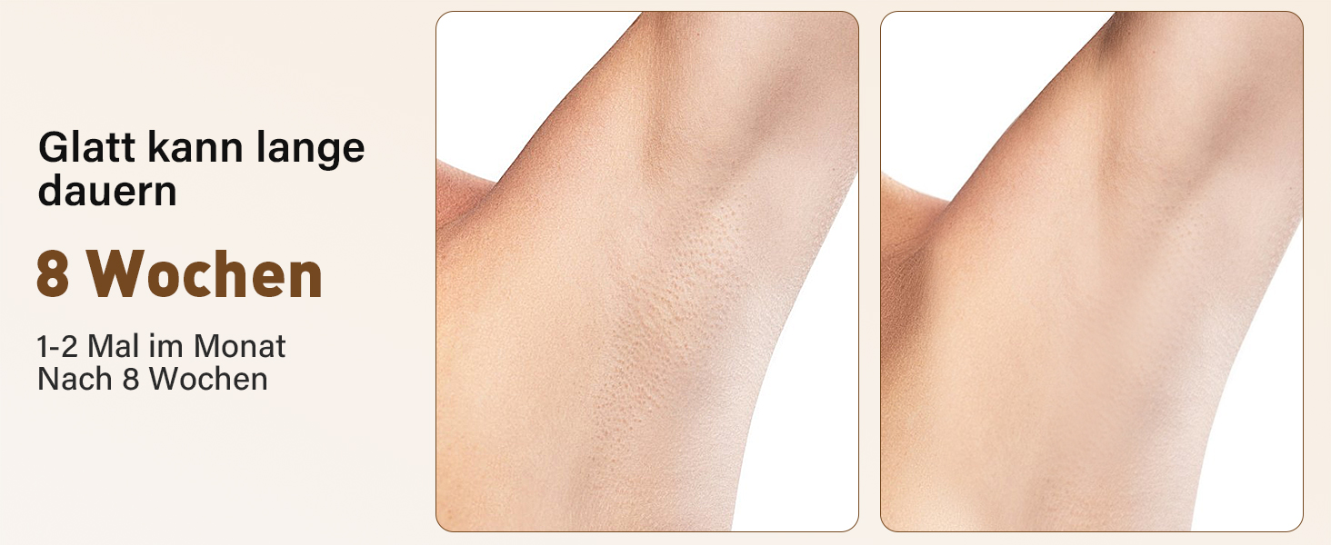 Пристрій для епіляції IPL з лазером та охолодженням, 3 функції (HR/SC/RA), 9 рівнів енергії, 999 999 імпульсів, для чоловіків/жінок/обличчя/бікіні/тіла (білий)