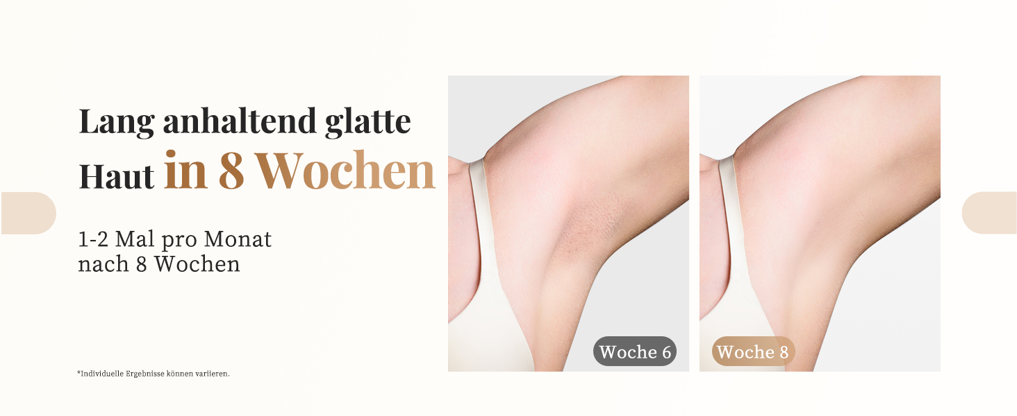 Пристрій для епіляції IPL Haarlosy - безболісна епіляція вдома для жінок та чоловіків, 9 рівнів, 999,900 імпульсів, 3 функції (HR/SC/RA), для тіла, ніг, зони бікіні, під пахвами, Platin