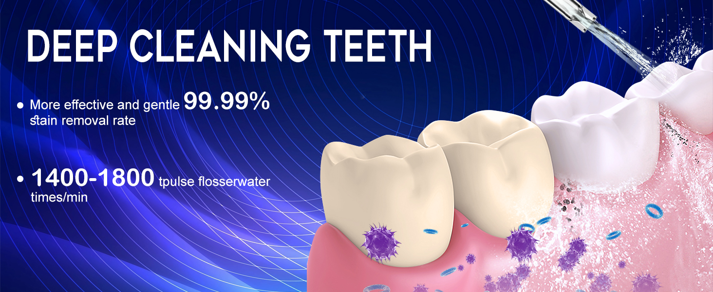 Іригатор для порожнини рота Wasser Dental з 4 режимами, 300 мл, для чищення зубів та міжзубних проміжків, портативний, IPX7, чорний