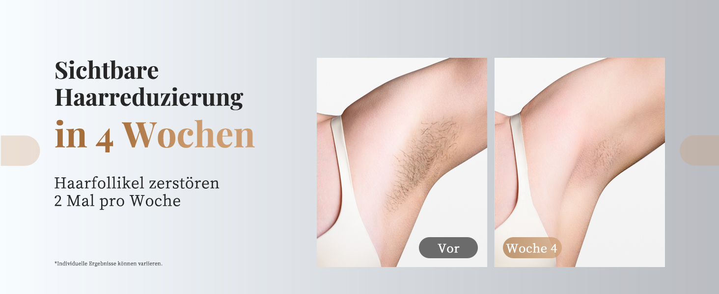 Пристрій для епіляції IPL Haarlosy: безболісна епіляція вдома для жінок та чоловіків, 9 рівнів, 999,900 імпульсів, 3 функції (HR/SC/RA), для тіла, ніг, зони бікіні, пахв. Чорний колір.