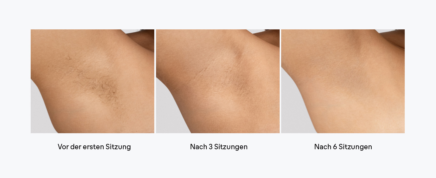 Braun Silk·expert Pro 5 IPL епілятор для безболісної епіляції вдома – білий/золотий (PL5442) + чохол, бритва Gillette Venus та 4 насадки. Зроблено в Німеччині