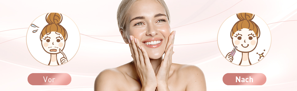 Електричний прилад для видалення волосся з обличчя URAQT для жінок, USB, безболісний епілятор, тример для обличчя, тіла, губ, підборіддя, з LED-підсвічуванням, рожеве золото