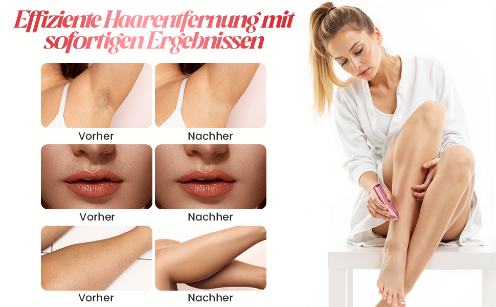 Електричний жіночий епілятор для тіла та обличчя, для інтимної зони, мокрий/сухий, з USB-зарядкою, рожевий