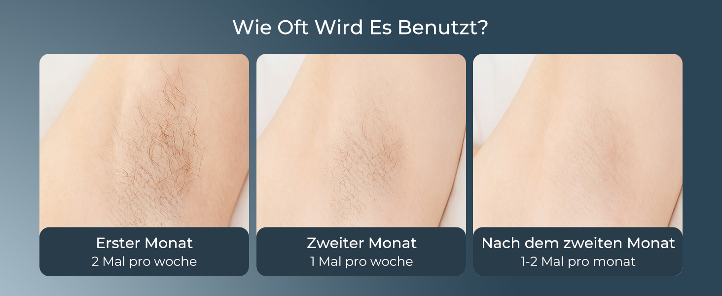 Пристрій для епіляції IPL 21J: Лазерний епілятор з 9 рівнями та червоним світлом 600 нм, 999,900 імпульсів для дому - для жінок та чоловіків, для обличчя, тіла, зони бікіні та ніг