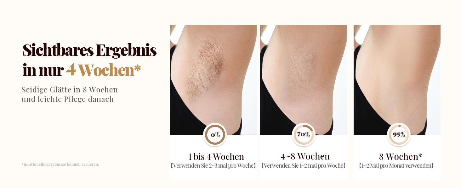 Пристрій для епіляції IPL Laser - Безболійний пристрій для видалення волосся IPL з 9 рівнями інтенсивності, 999,900 світлових імпульсів для дому, тіла, обличчя, зони бікіні та пахв (Бежевий)