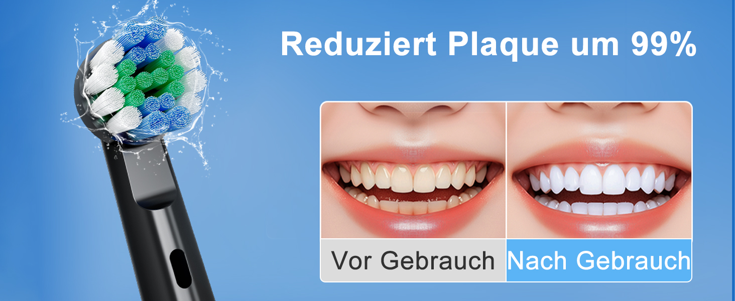 Електрична зубна щітка Rotierende для дорослих з 8 насадками, 3 режимами чищення, акумулятором до 50 днів та Smart-таймером 2 хв - Чорна