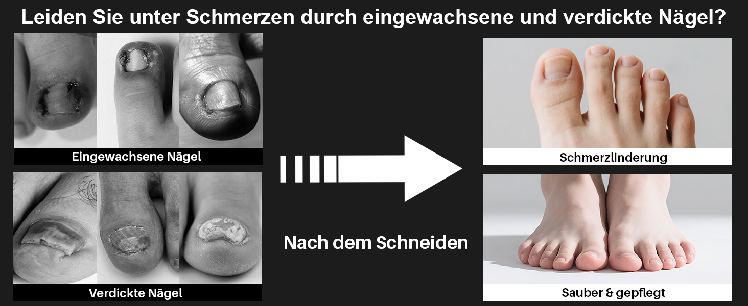Професійний нігтеріз для нігтів на ногах - нігтеріз для пальців ніг, великий для людей похилого віку, товсті нігті з широким отвором, гострий інструмент для обрізання нігтів, набір для догляду за нігтями з довгим руків'ям та скошеним вигином леза для чоловіків та жінок, чорний