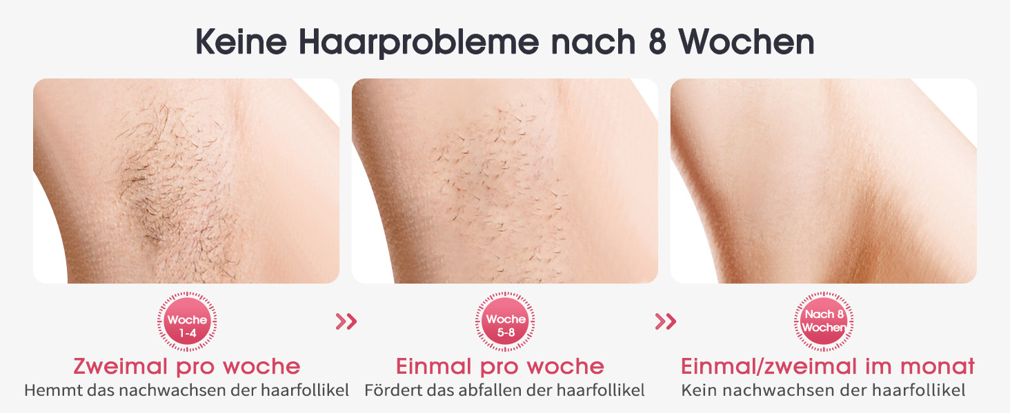 Пристрій для епіляції IPL Haarlosy з охолодженням, 999,900 імпульсів світла, 5 рівнів потужності, безболісна епіляція IPL, лазерне видалення волосся для жінок та чоловіків, для зони бікіні, тіла та ніг - Рожевий