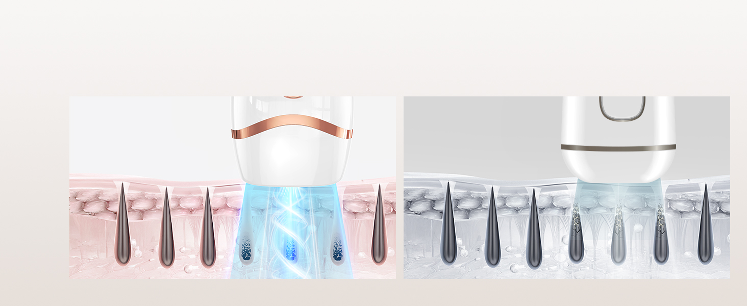 IPL пристрій для епіляції Haarlosy: 999,900 імпульсів, 3 функції, 9 рівнів, для чоловіків та жінок, безболісна епіляція тіла, обличчя, бікіні